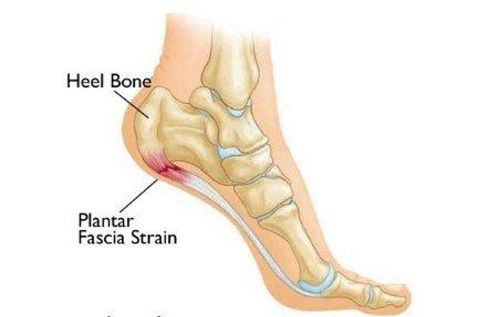 Heel Bone And Foot Pain