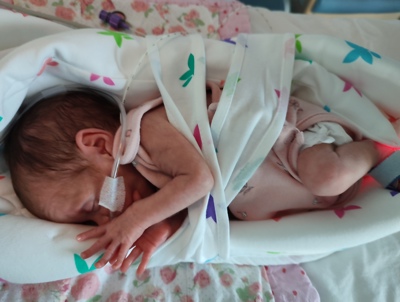 A premature baby in the Victoria Hospital's Neonatal Unit benefiting from one of the special support aids funded by Fife Health Charity.