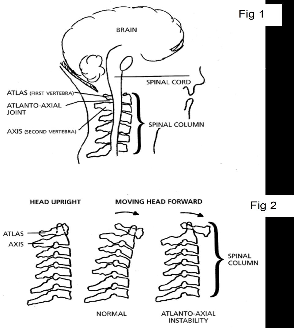 Cervical spine diagram
