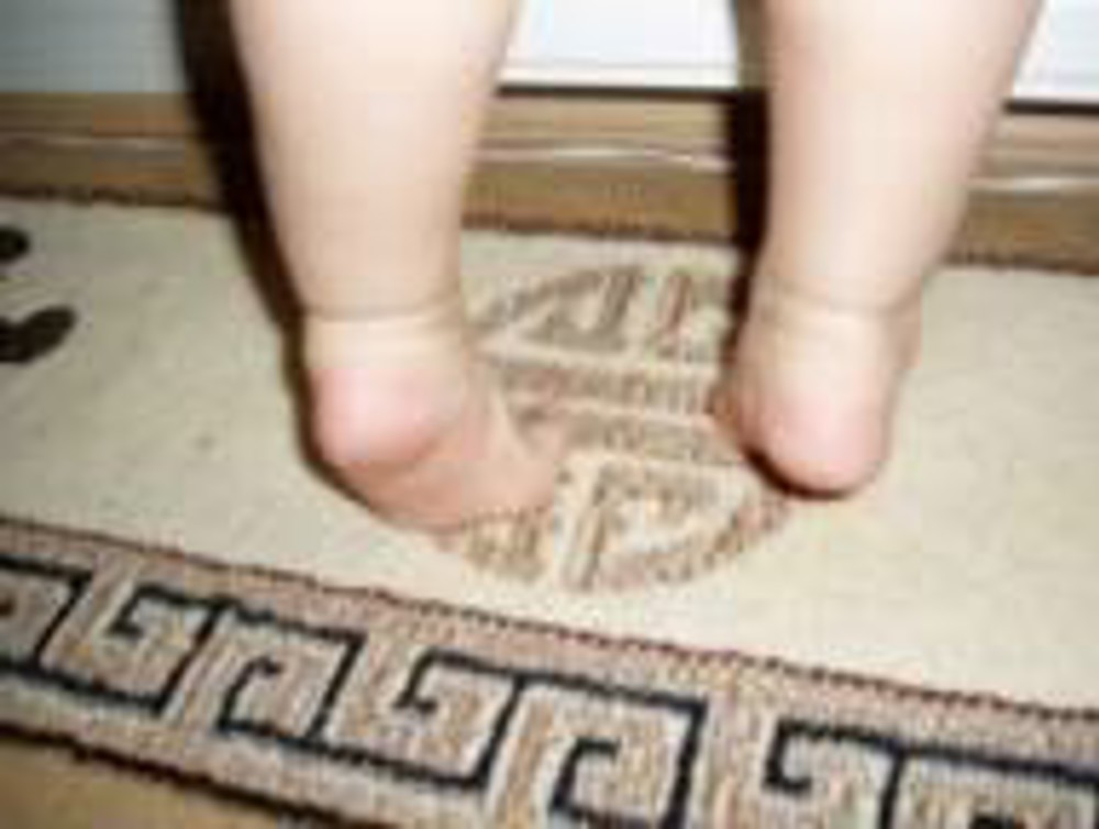 Flat Feet Of A Two Year Old 3